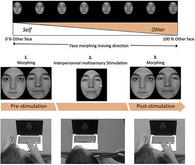 The enfacement illusion in autism spectrum disorder: How interpersonal multisensory stimulation influences facial recognition of the self